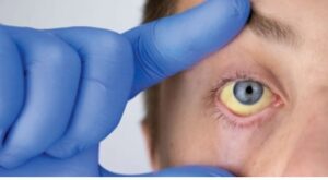 Read more about the article HEALTH: LIVING WITH ANAEMIA.